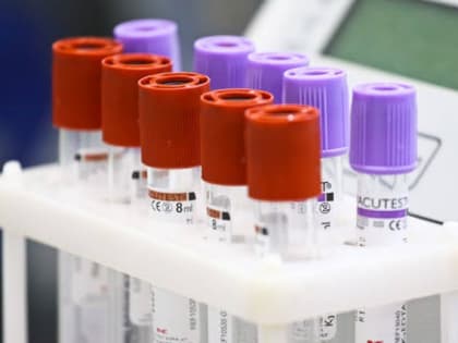 За два месяца более тысячи новорожденных в Калининградской области прошли неонатальный скрининг