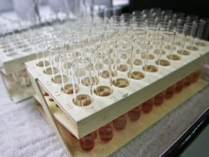 Калининградцам предлагают бесплатно проверить уровень сахара в крови