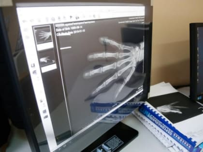 В шесть больниц Калининградской области поставят новые рентген-аппараты за 156 млн рублей