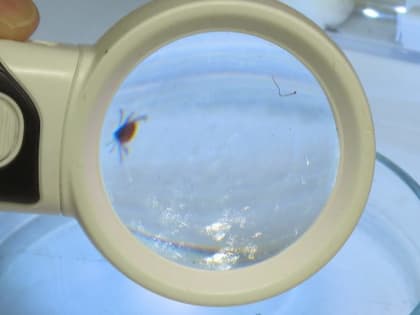 Региональное управление Роспотребнадзора информирует о регистрации первого в 2023 году случая заболевания клещевым энцефалитом