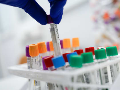 Роспотребнадзор: из-за непривитых мигрантов в России растет заболеваемость корью