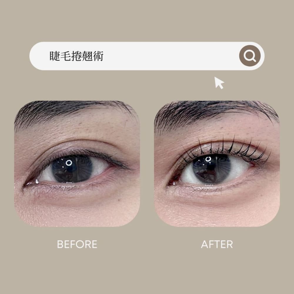 睫毛捲翹術