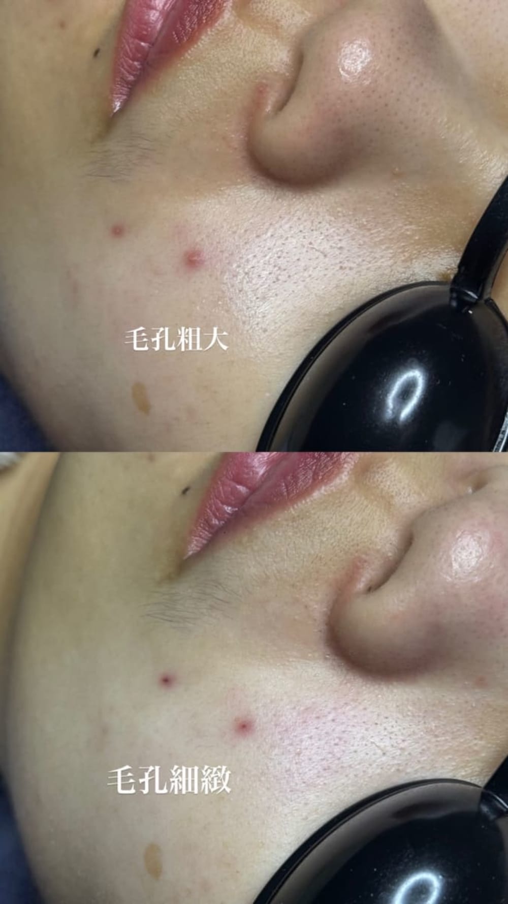 基礎保溼/杏仁酸煥膚/水光保濕/矽晶煥膚