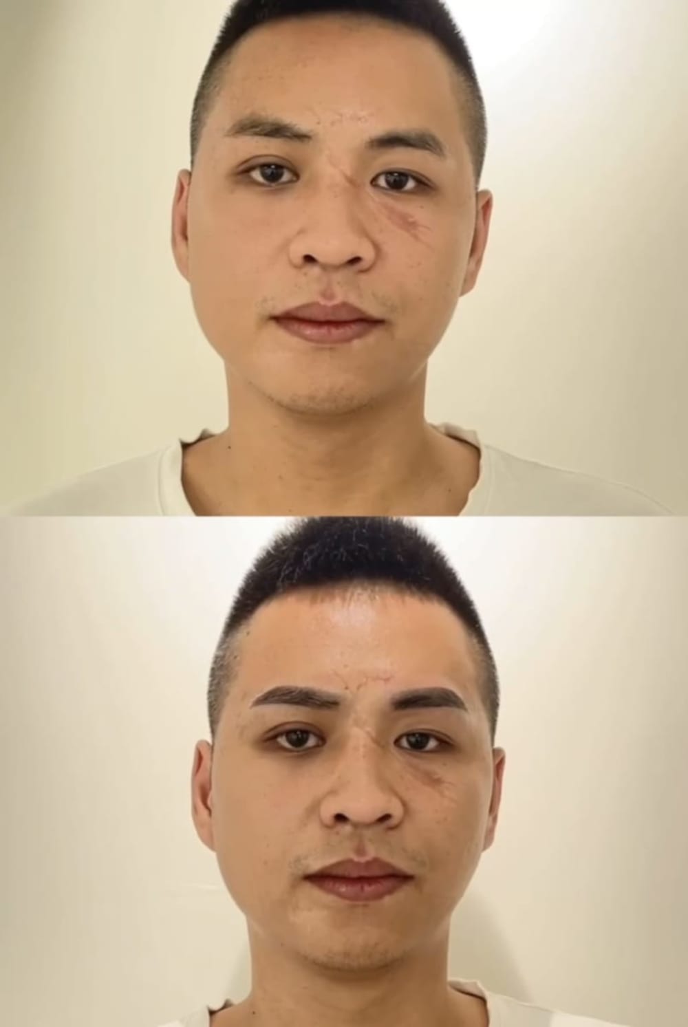 男士霧眉
