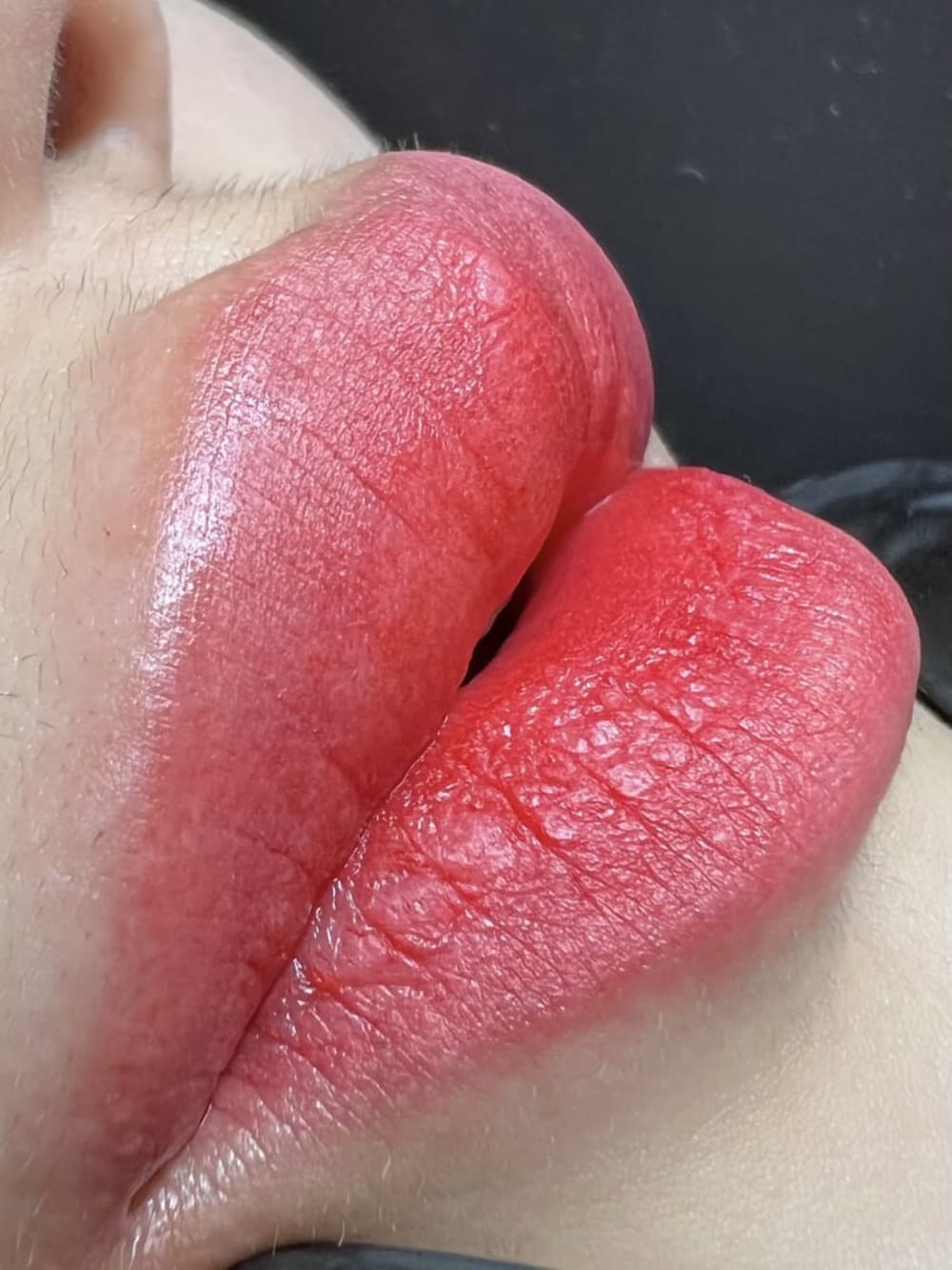 霧唇