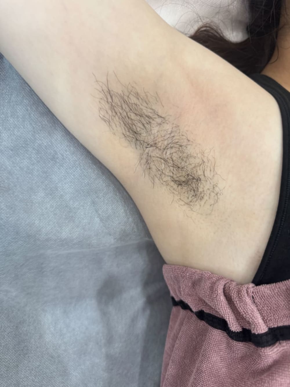 熱蠟美肌-腋下