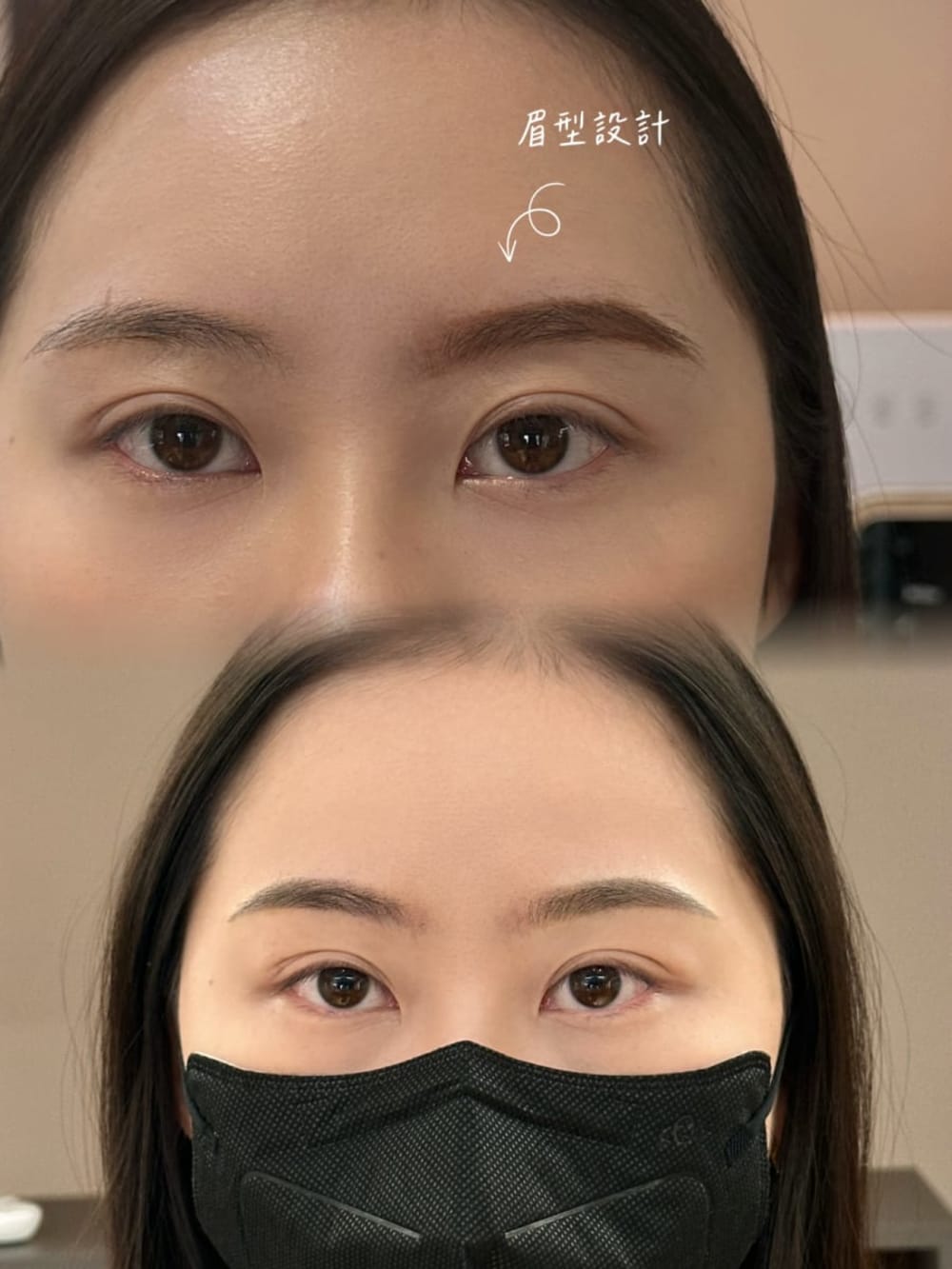 Before/After 
