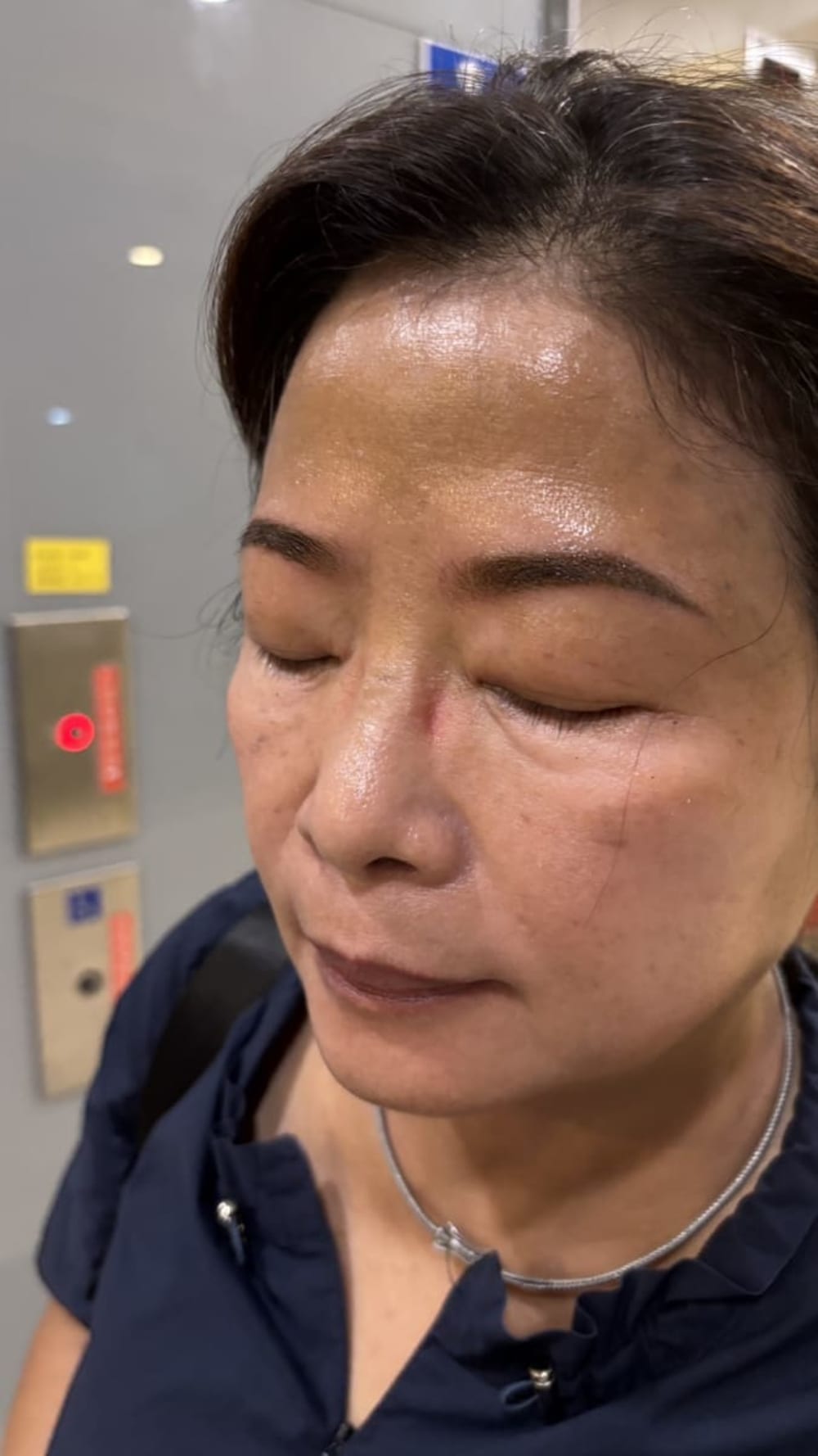 霧眉
