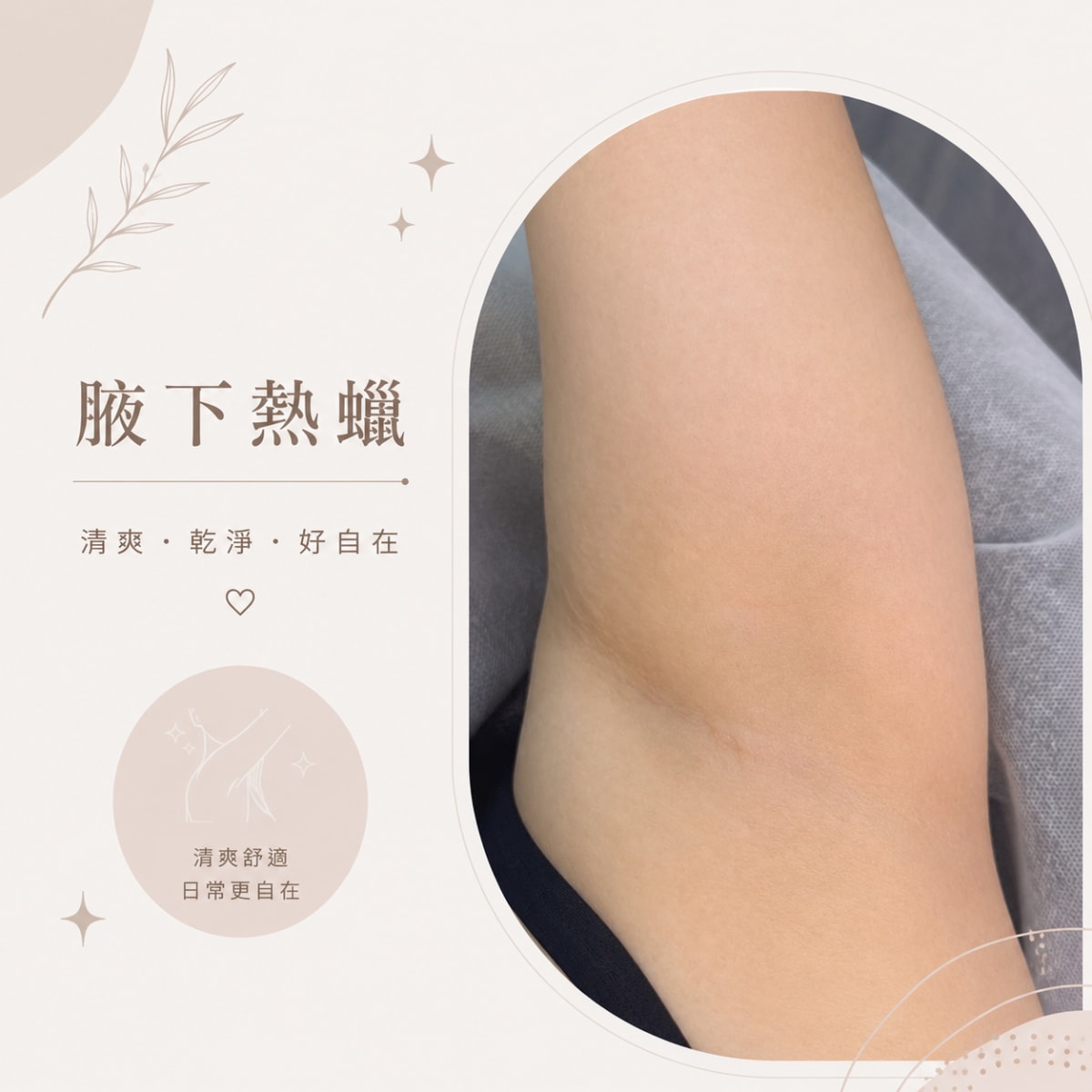 新北市林口區除毛作品 — Queenie老師 熱蠟美肌-腋下