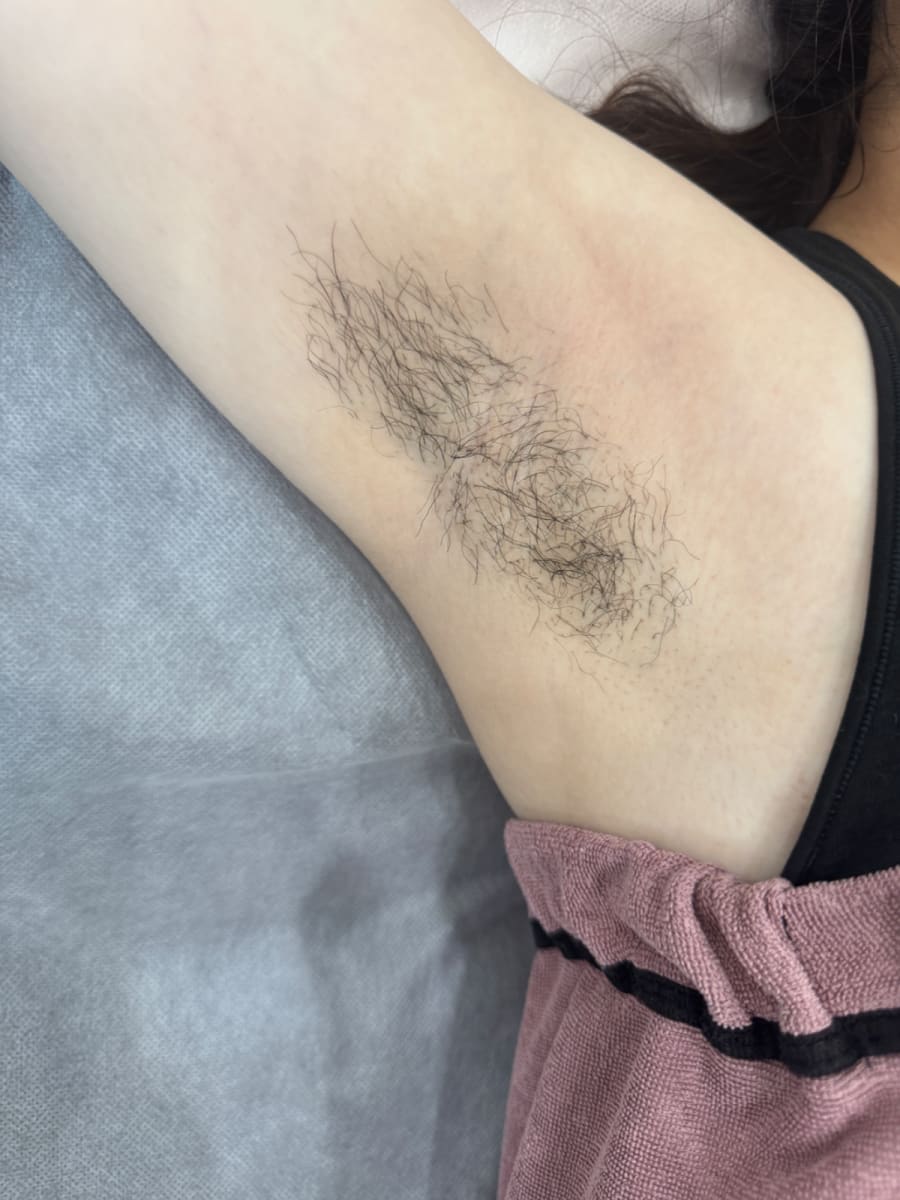 新竹縣除毛作品,Rita老師,熱蠟美肌-腋下