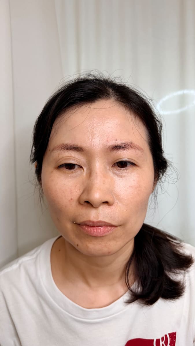 彰化縣彰化市皮膚管理作品 — 安安老師 紅眉轉色