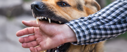 A dog biting someone's hand