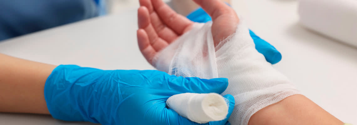 Doctor bandaging patient's burned hand indoors
