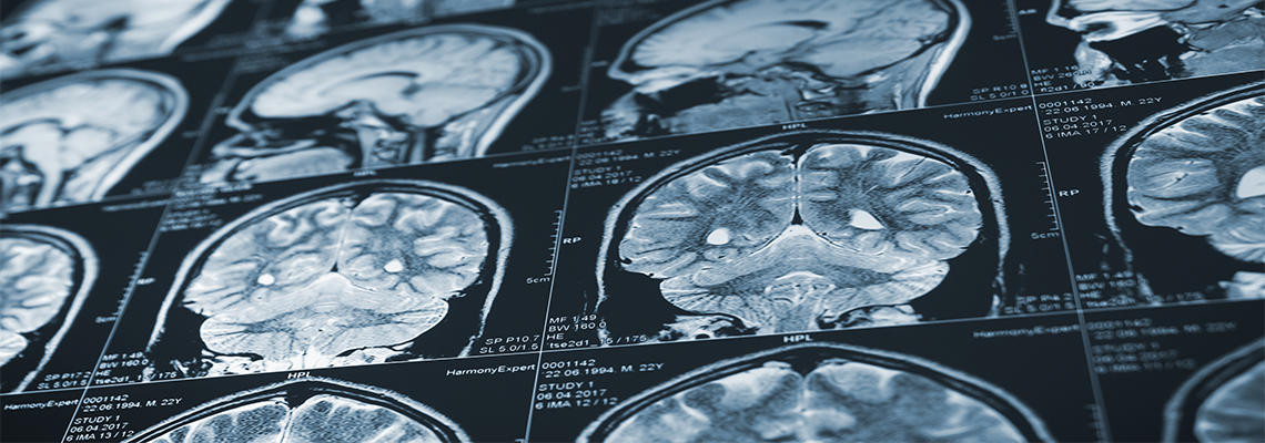 Close up series of a CT scan with human head on it. X-ray medicine concept