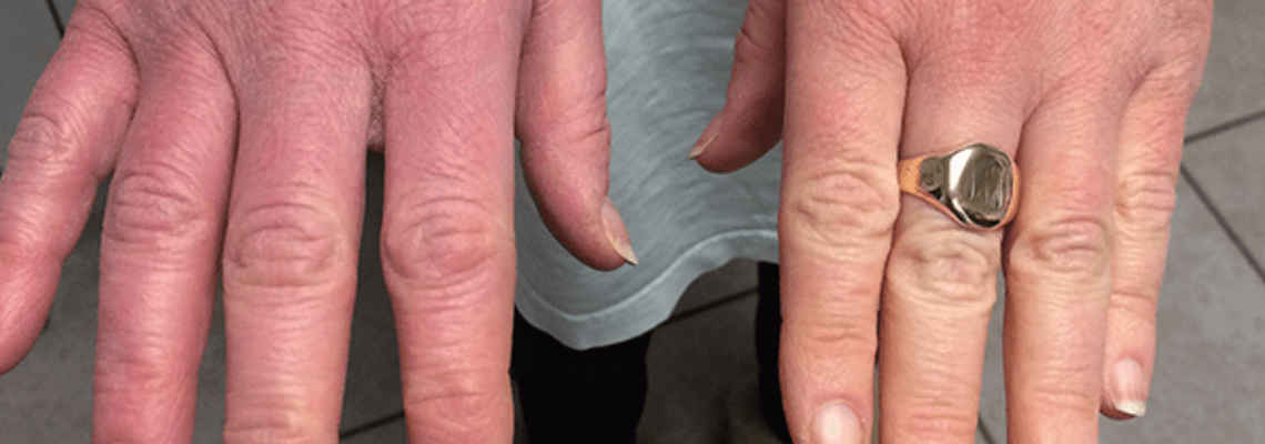 Hands
