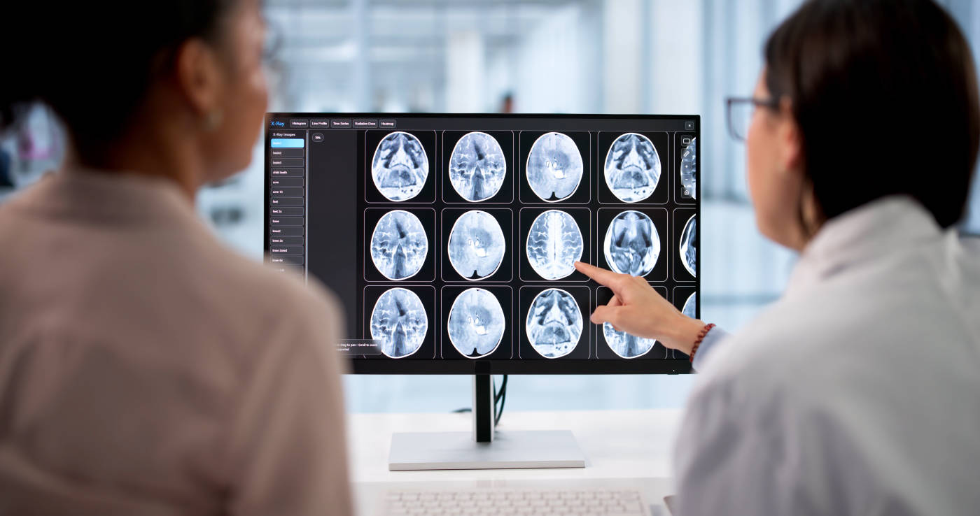 patient and doctor looking at brain scan