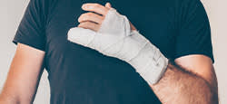 Man with arm in cast