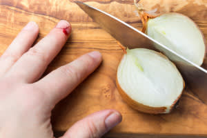 Person cutting onion with bloody finger tip