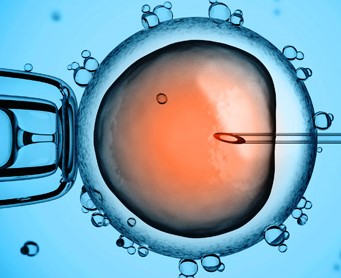 assisted reproduction