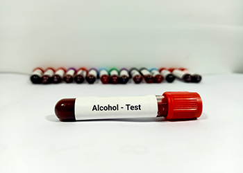 Test Tube with blood sample for Alcohol Test