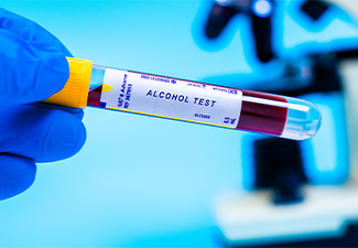 Measures blood alcohol concentration, commonly used to assess intoxication levels
