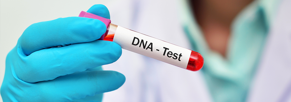Test tube with blood sample for DNA test
