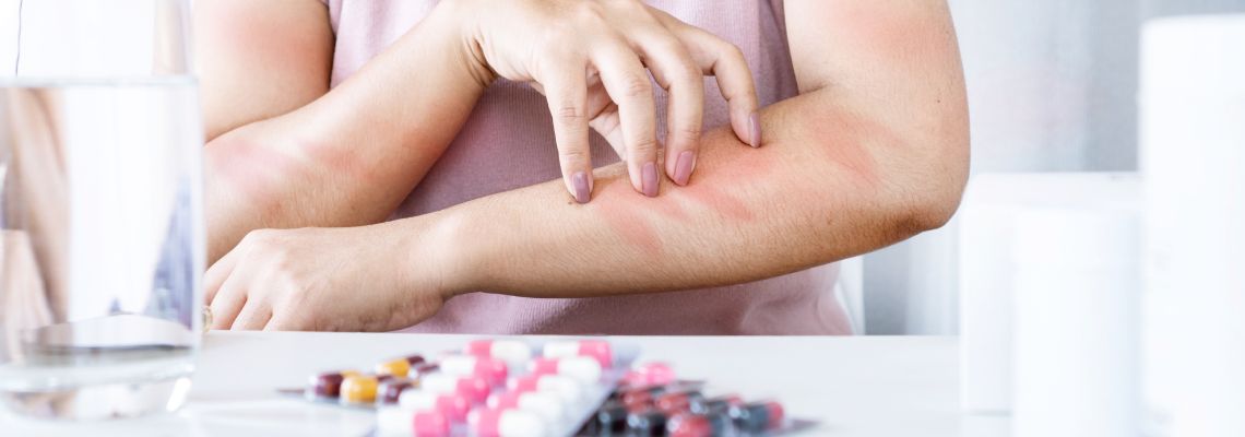 Woman Experiencing Allergic Reaction to Medication