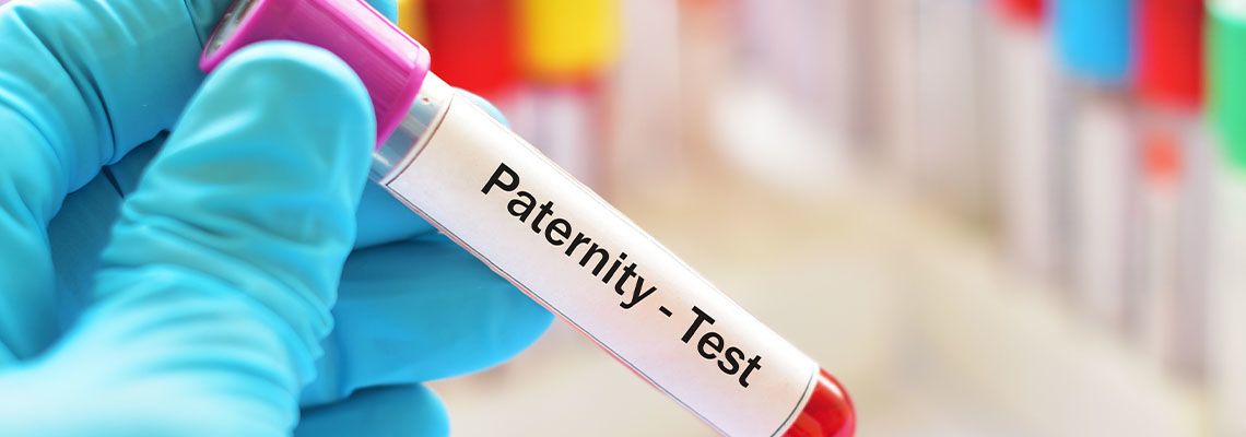 Test tube with blood sample for paternity test