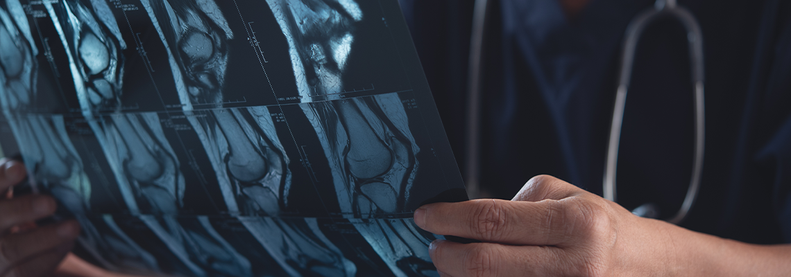 Doctor holding and looking patient bone x-ray film before surgery