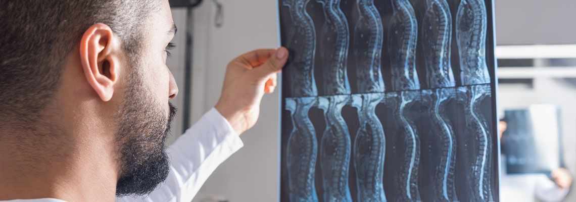 Doctor looking at spinal cord Xray