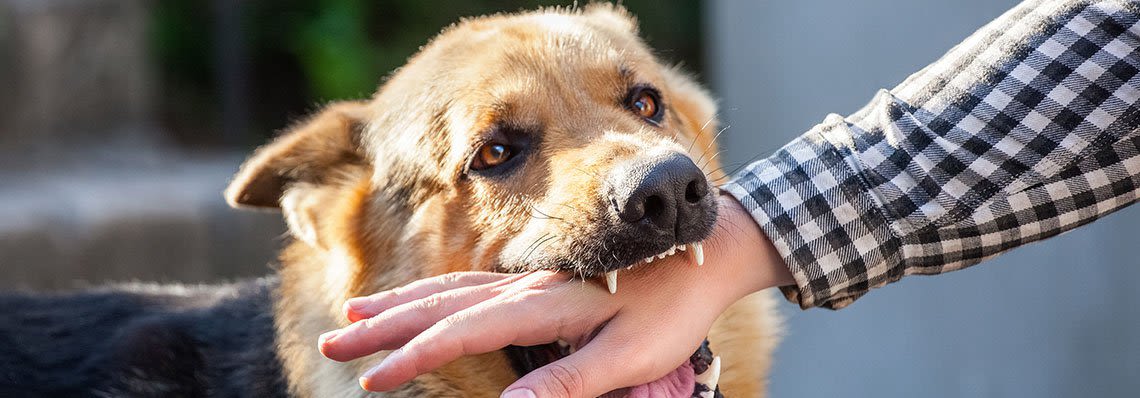 Dog biting a man's hand