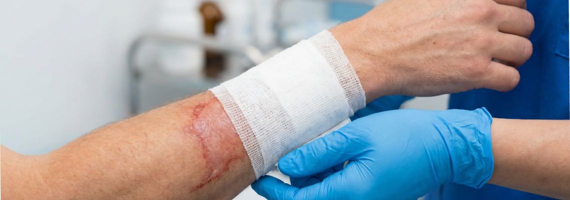 Medical Professional Applying Gauze Bandage in injured arm