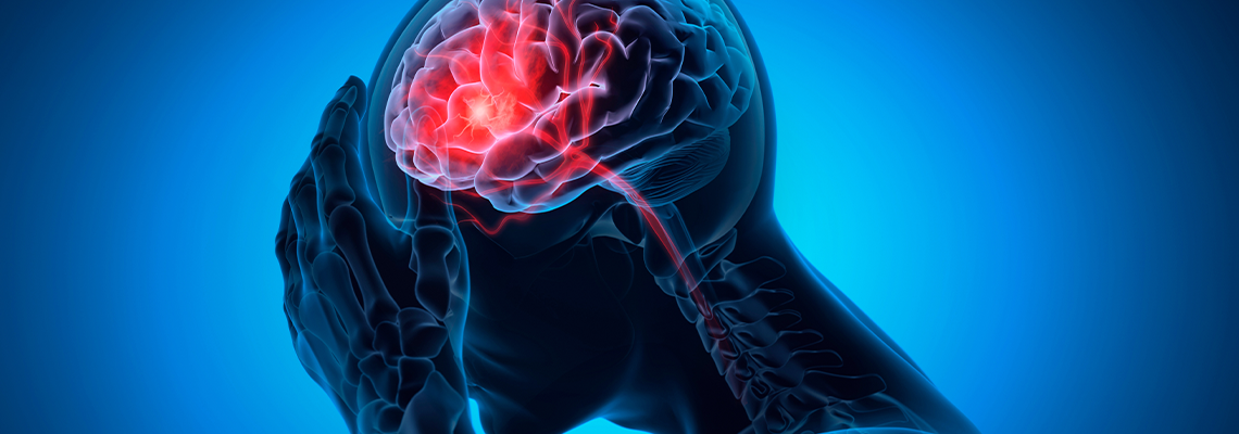 Man with a headache - Brain Stroke 3d art