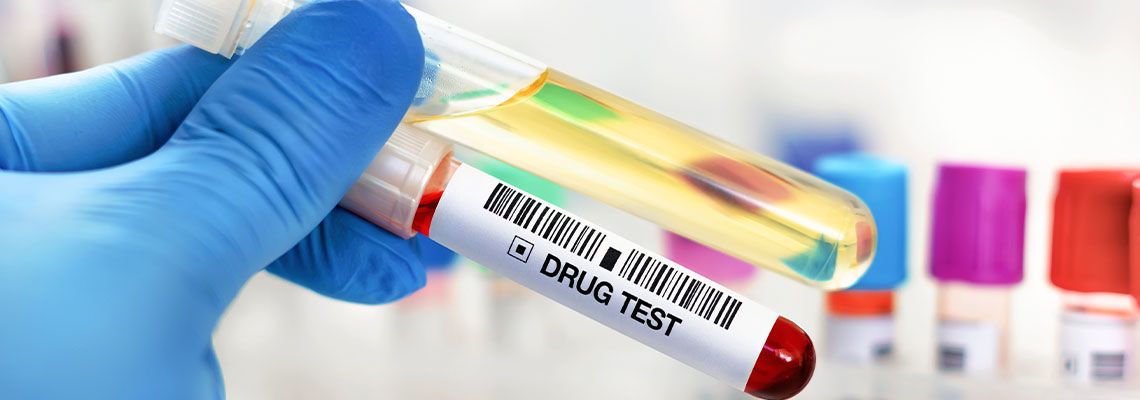 Doctor holding test tube with samples for drug test