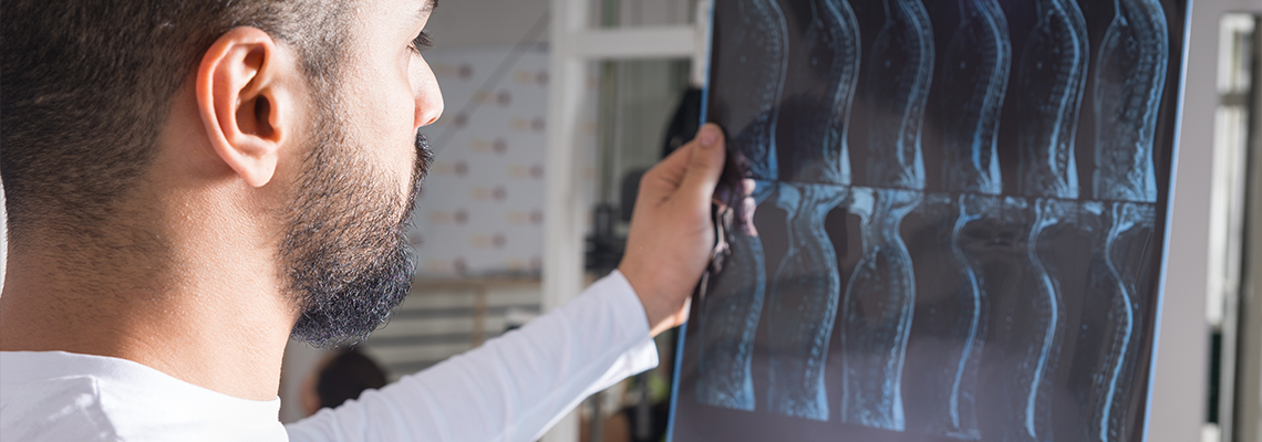 Doctor analysing X-ray image of spine