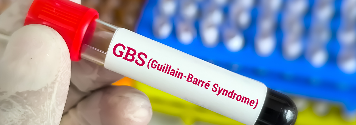 Guillain-Barre syndrome (GBS) test, a rare disorder where the body's immune system damages nerve