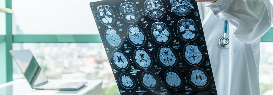 Brain disease diagnosis with medical doctor seeing Magnetic Resonance Imaging (MRI) film