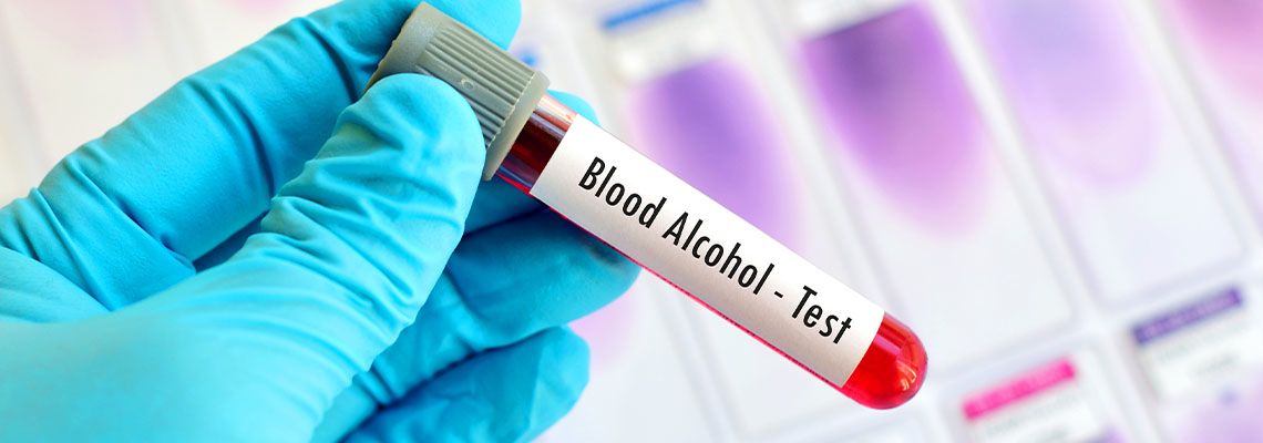 Hands holding Blood sample for alcohol test