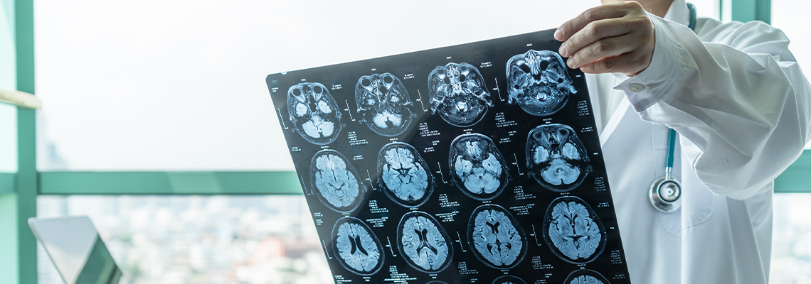 Brain disease diagnosis with medical doctor seeing Magnetic Resonance Imaging (MRI)
