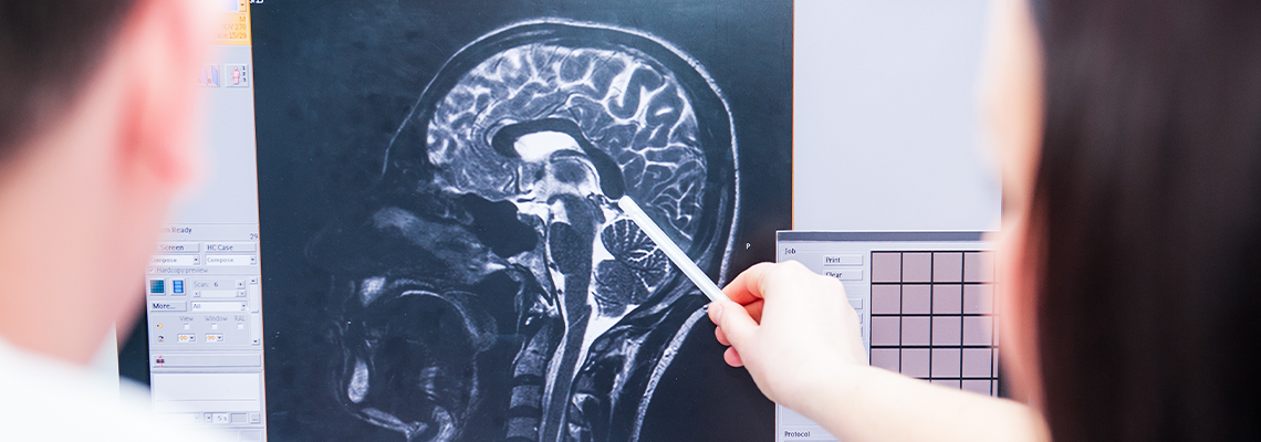 Doctors consider and discuss magnetic resonance image (MRI) of the brain