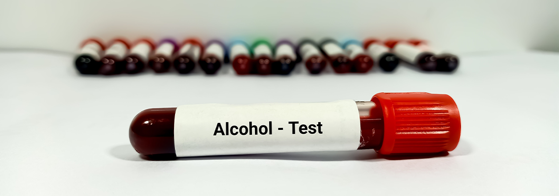 Test Tube with blood sample for Alcohol test