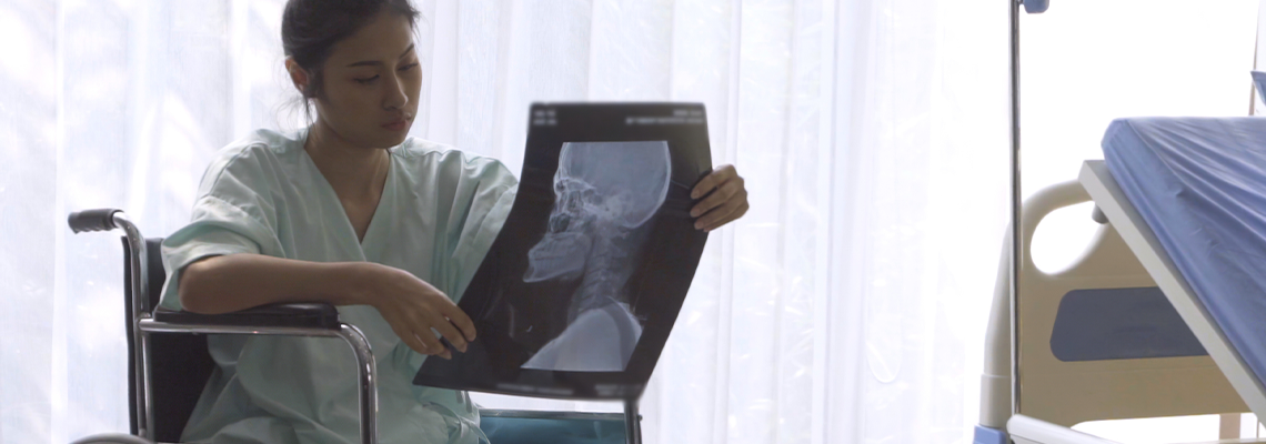 Serious patient looking at x-ray image of her brain injury surgery