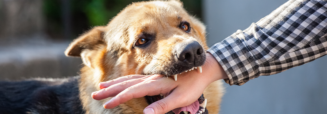 An adult, aggressive male German shepherd attacks a man and bites his hand