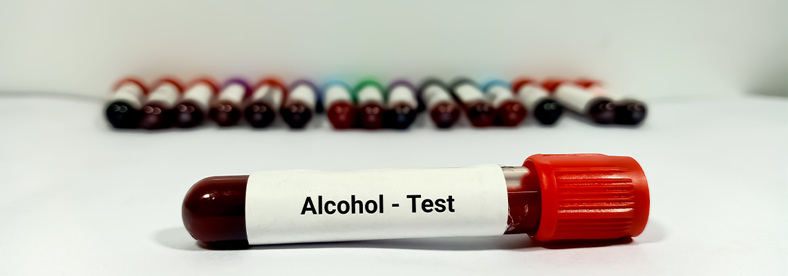 Test Tube with blood sample for Alcohol test