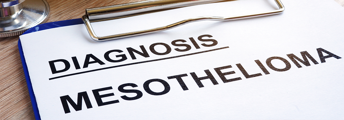 Diagnosis Mesothelioma and stethoscope on a desk.