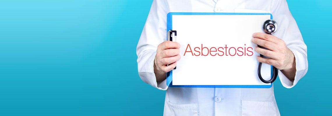 Doctor holding paper with word Asbestosis