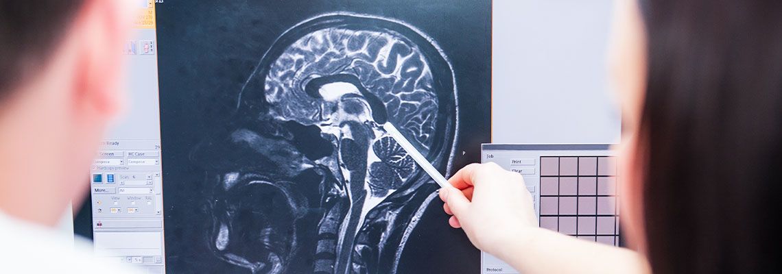 Doctor looking at MRI of brain
