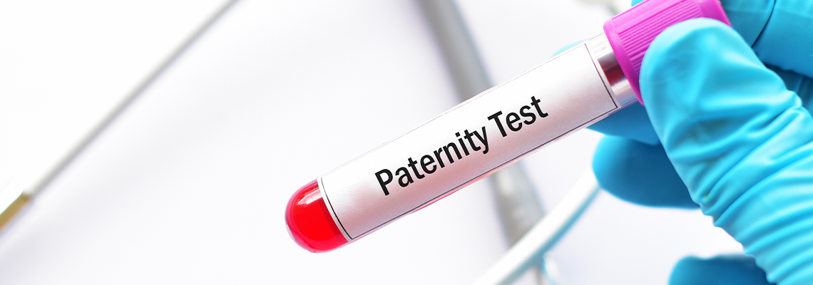 Test tube with blood sample for paternity test
