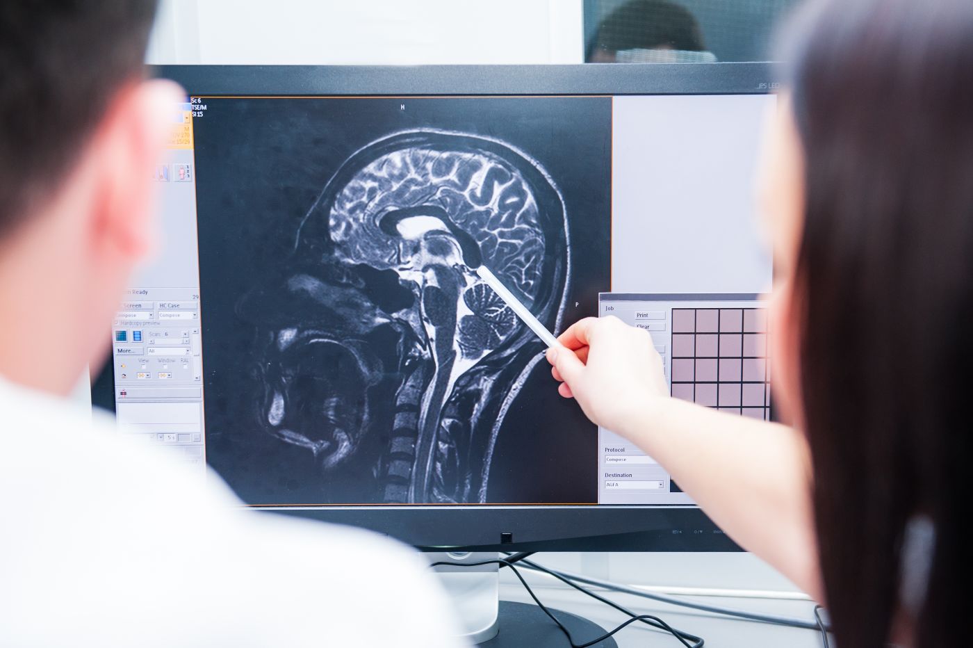 Doctor discussing Brain MRI