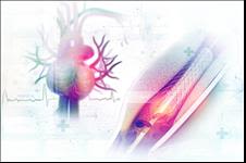 Cardiac Stent graphic